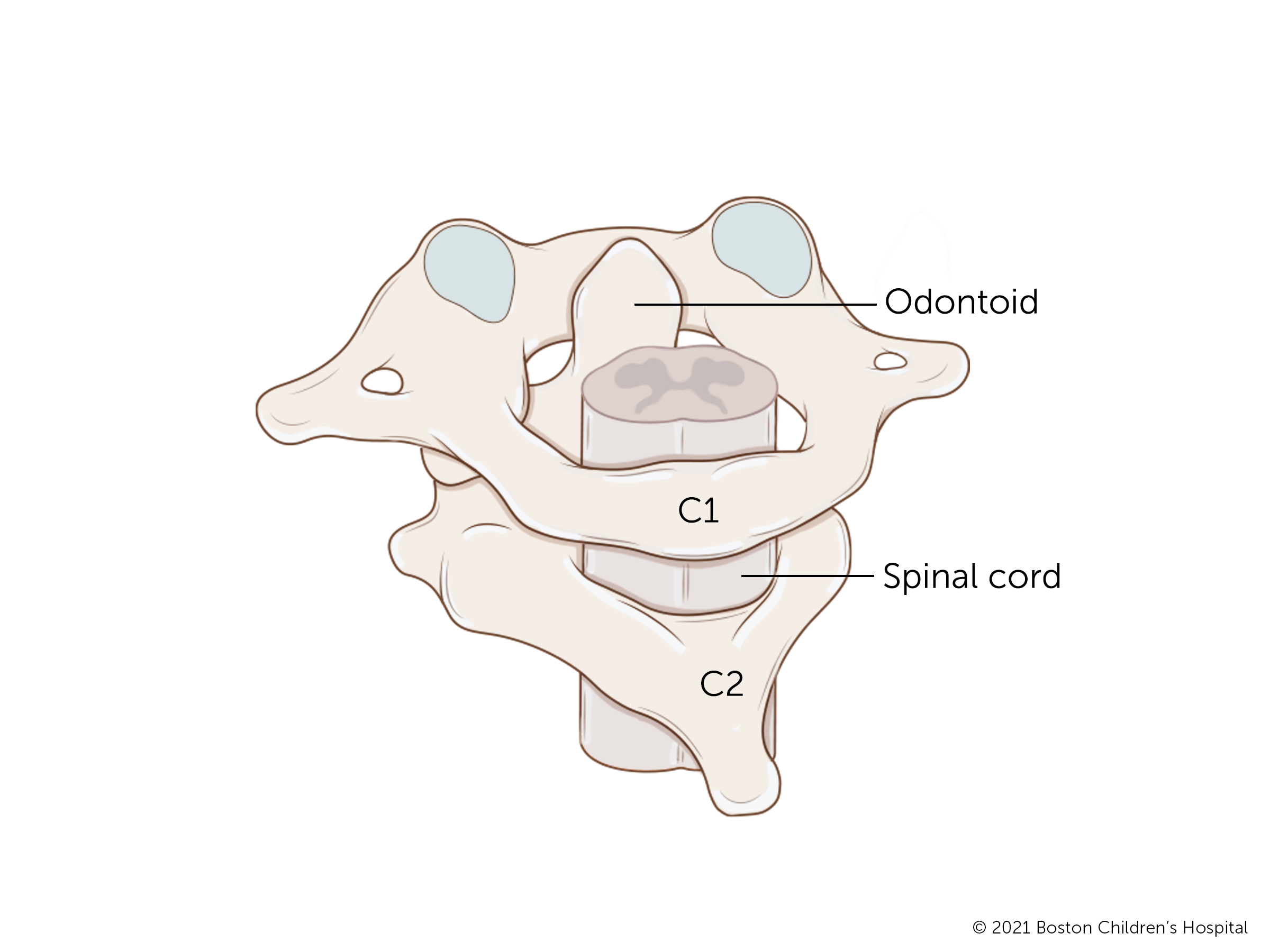 位于脊柱顶部的C1和C2椎体由齿状突连接。