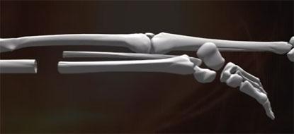 小腿骨与大腿骨相连的医学图解